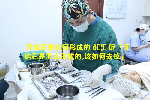 牙结石是如何形成的 🦍 呢「牙结石是怎么形成的,该如何去掉」